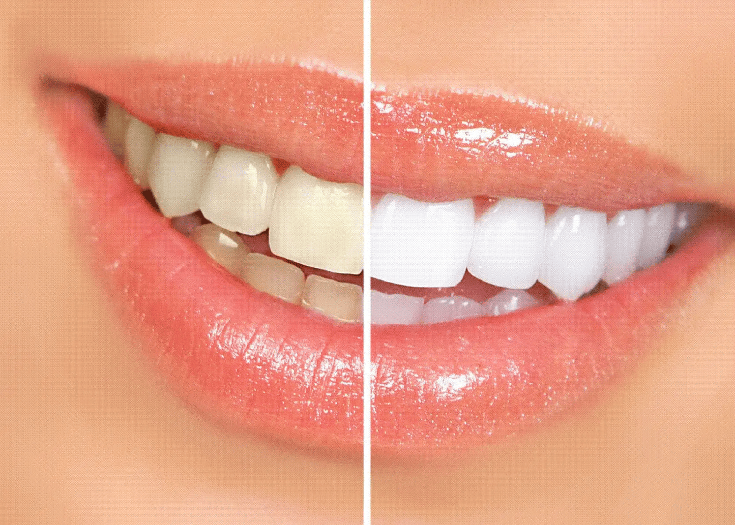 Cepillo de Dientes Electrico